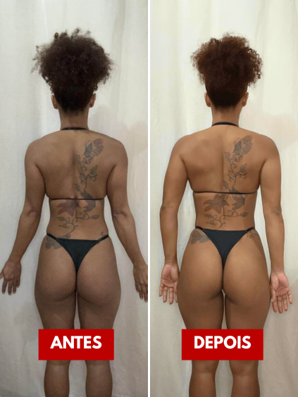antes e depois