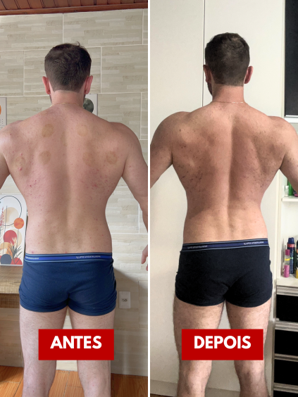 antes e depois