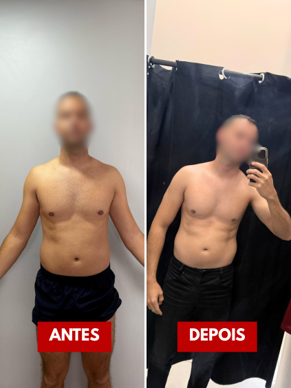 antes e depois